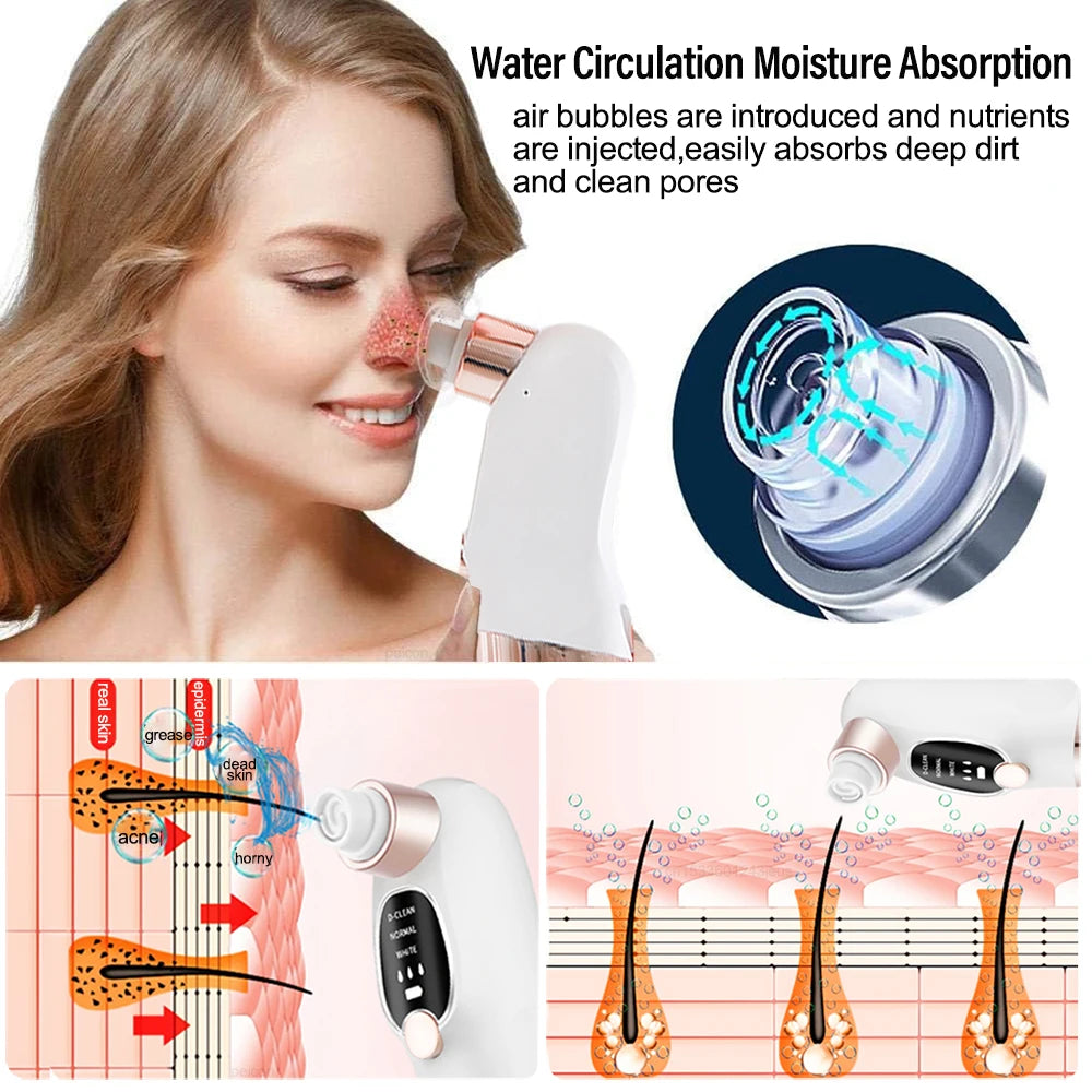 Blackhead Remover Electric BlackHead Extractor Pore Vacuum Cleaner Micro Small Bubble Acne Nose Deep Cleaning Black Head Remover